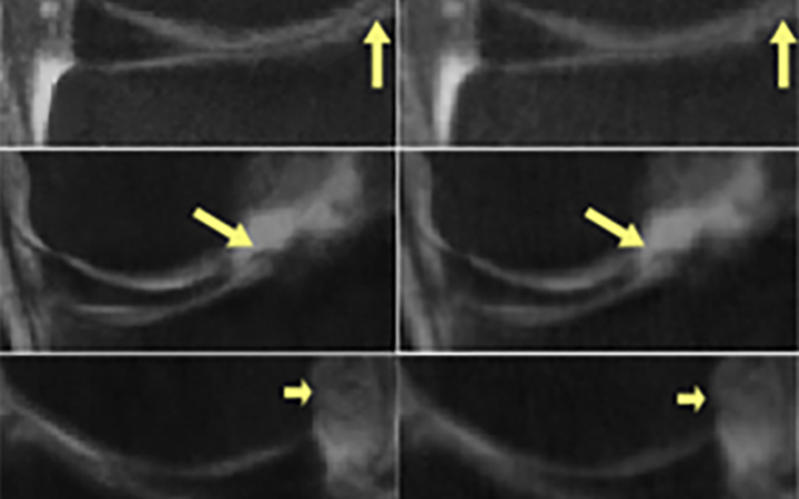 Medical scan 