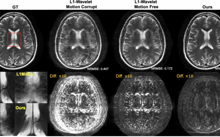 Generative MRI