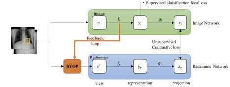 Knowledge-Augmented Contrastive Learning for Abnormality Classification and Localization in Chest X-rays with Radiomics using a Feedback Loop 2